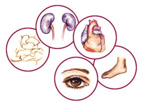 Organi a cui complicanze del diabete mellito